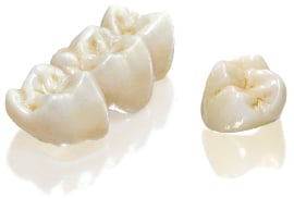 All Porcelain Crowns