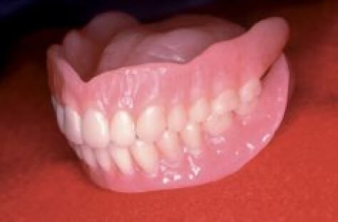 Dental Dentures