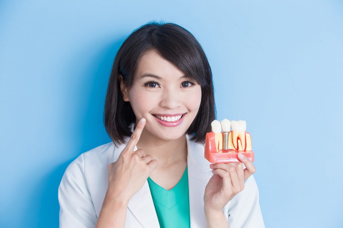 Top Reasons For Choosing Dental Implants