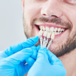 Dental Veneers: 7 Amazing Benefits of Veneers You Did Not Know