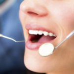 What Are Dental Crowns and When Are They Needed?