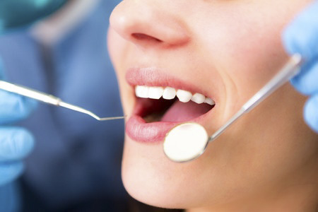 What Are Dental Crowns and When Are They Needed?