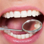 All You Need to Know About Composite Fillings and How to Care For Them