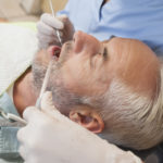 How Long Does a Root Canal Take?